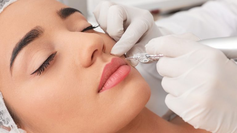 Are There Risks of Combining Lip Blushing with Lip Fillers?